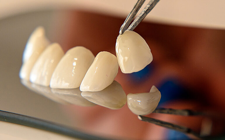 proteica dentara berceni bucuresti